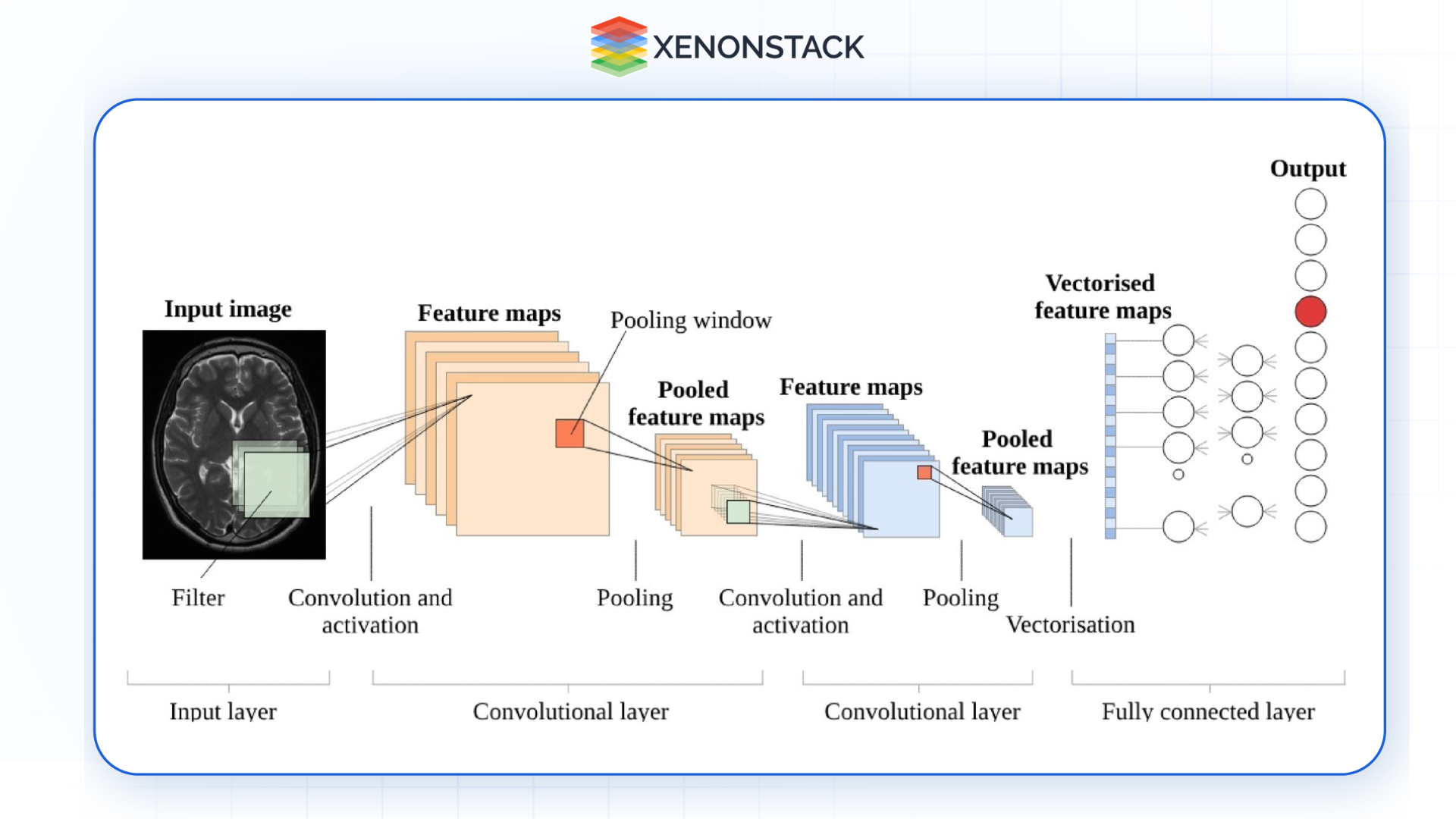 ai model processing mris brain